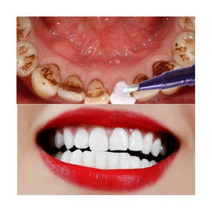 Branqueador Dental Caneta Compre 2 Leve 3